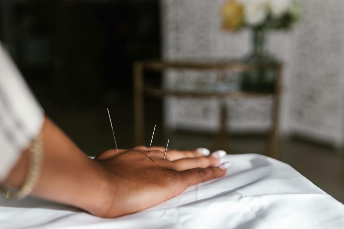 How acupuncture supports fertility